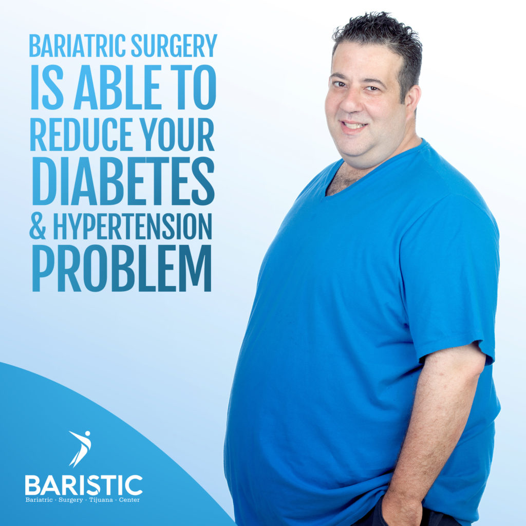 10 faq about Bariatric Surgery | BARISTIC